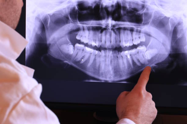 Best Tooth Infection Emergency Dentist  in West Columbia, TX