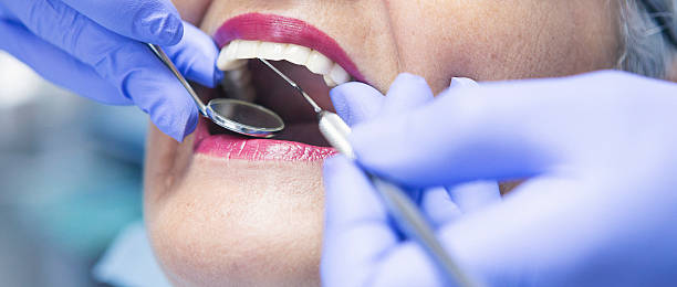 Best Chipped Tooth Repair Near Me  in West Columbia, TX